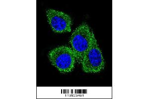 Confocal immunofluorescent analysis of GCDFP-15 Antibody with MDA-MB231 cell followed by Alexa Fluor 488-conjugated goat anti-rabbit lgG (green). (PIP 抗体  (C-Term))