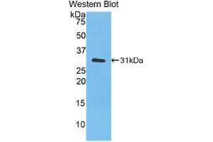 Western blot analysis of recombinant Human CA3. (CA3 抗体  (AA 2-260))