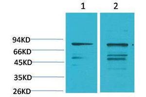 Western Blotting (WB) image for anti-Phosphoinositide 3 Kinase, p85 alpha (PI3K p85a) antibody (ABIN3179081) (PIK3R1 抗体)