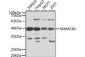 Western blot analysis of extracts of various cell lines, using SMARCB1 antibody. (SMARCB1 抗体)