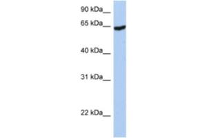 Western Blotting (WB) image for anti-Insulin-Like Growth Factor 2 mRNA Binding Protein 1 (IGF2BP1) antibody (ABIN2462219) (IGF2BP1 抗体)