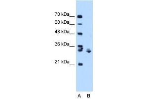 WB Suggested Anti-XBP1 Antibody Titration:  0. (XBP1 抗体  (C-Term))