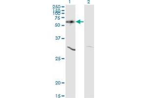 Western Blotting (WB) image for anti-V-Akt Murine Thymoma Viral Oncogene Homolog 1 (AKT1) (AA 1-481) antibody (ABIN598531) (AKT1 抗体  (AA 1-481))