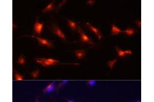 Immunofluorescence analysis of U-251MG cells using Nestin Polyclonal Antibody at dilution of 1:100 (20x lens). (Nestin 抗体)