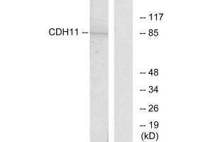 Western Blotting (WB) image for anti-Cadherin 11 (CDH11) (Internal Region) antibody (ABIN1850215) (OB Cadherin 抗体  (Internal Region))