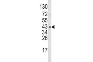 Western blot analysis of WNT5B antibody and mouse bladder tissue lysate. (WNT5B 抗体  (AA 153-182))