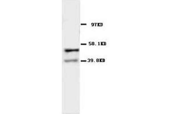 CHRNA1 抗体  (N-Term)