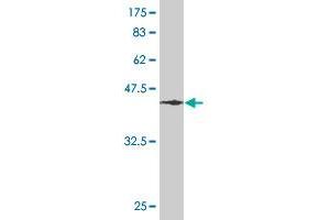 Western Blot detection against Immunogen (46. (RHOA 抗体  (AA 1-193))