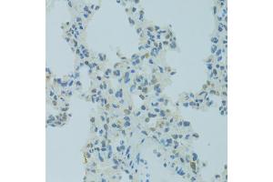 Immunohistochemistry of paraffin-embedded rat lung using MBD2 antibody (ABIN5971247) at dilution of 1/100 (40x lens). (MBD2 抗体)