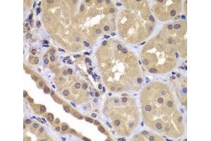 Immunohistochemistry of paraffin-embedded Human kidney using BAG2 Polyclonal Antibody at dilution of 1:100 (40x lens). (BAG2 抗体)