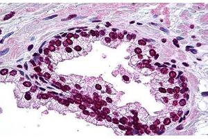 Human Prostate: Formalin-Fixed, Paraffin-Embedded (FFPE) (DLX2 抗体  (AA 1-110))