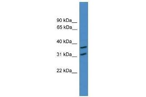 Western Blot showing OTUD6A antibody used at a concentration of 1-2 ug/ml to detect its target protein. (OTUD6A 抗体  (N-Term))