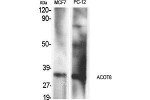 Western Blot (WB) analysis of specific cells using ACOT8 Polyclonal Antibody. (ACOT8 抗体  (Internal Region))