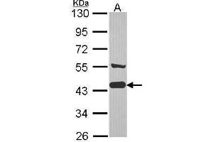 WB Image Sample (30 ug of whole cell lysate) A: JurKat 10% SDS PAGE AHA-1 antibody antibody diluted at 1:1000 (AHSA1 抗体  (Center))
