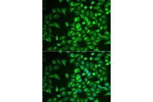 Immunofluorescence analysis of U2OS cells using LRAT antibody. (LRAT 抗体)