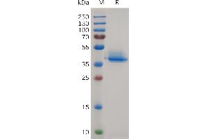 Canis A Protein, His Tag on SDS-PAGE under reducing condition. (Annexin A2 Protein (ANXA2) (AA 2-339) (His tag))