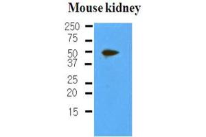 Western Blotting (WB) image for anti-Podoplanin (PDPN) antibody (ABIN306460) (Podoplanin 抗体)