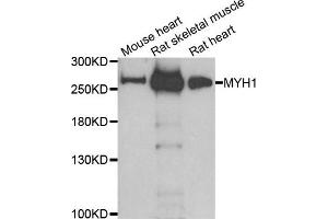 Western blot analysis of extracts of various cell lines, using MYH1 antibody. (MYH1 抗体)