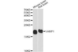 Western blot analysis of extracts of various cell lines, using VAMP1 antibody (ABIN5995694) at 1/1000 dilution. (VAMP1 抗体)