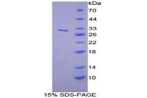 SDS-PAGE analysis of Mouse MUSK Protein. (MUSK 蛋白)