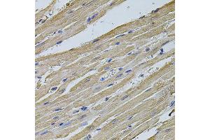 Immunohistochemistry of paraffin-embedded rat heart using EIF4A2 antibody (ABIN5972034) at dilution of 1/100 (40x lens). (EIF4A2 抗体)