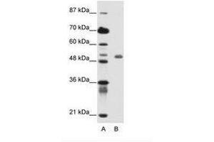 Image no. 1 for anti-Deformed Epidermal Autoregulatory Factor 1 (Drosophila) (DEAF1) (C-Term) antibody (ABIN6736145) (DEAF1 抗体  (C-Term))