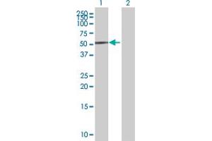 Lane 1: BRE transfected lysate ( 47 KDa) Lane 2: Non-transfected lysate. (BRE 293T Cell Transient Overexpression Lysate(Denatured))