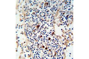 Paraformaldehyde-fixed, paraffin embedded human lymph tissue, Antigen retrieval by boiling in sodium citrate buffer (pH6. (kappa Light Chain 抗体)