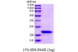 SDS-PAGE (SDS) image for SlyD (AA 1-196) protein (ABIN667072) (SlyD (AA 1-196) 蛋白)