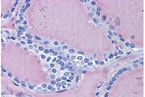 Human Thyroid: Formalin-Fixed, Paraffin-Embedded (FFPE) (Thyroglobulin 抗体)