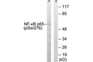 Western Blotting (WB) image for anti-Nuclear Factor-kB p65 (NFkBP65) (pSer276) antibody (ABIN2888487) (NF-kB p65 抗体  (pSer276))