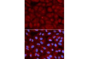 Immunofluorescence analysis of U2OS cells using BIN1 antibody. (BIN1 抗体)