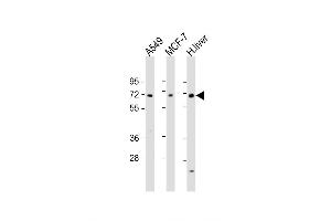 Western Blot at 1:1000-1:2000 dilution Lane 1: A549 whole cell lysate Lane 2: MCF-7 whole cell lysate Lane 3: human liver lysate Lysates/proteins at 20 ug per lane. (HABP2 抗体  (C-Term))