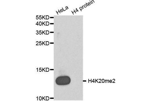 Histone H4 抗体  (2meLys20)