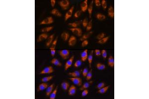 Immunofluorescence analysis of L929 cells using GRK5 Rabbit pAb (ABIN1680115, ABIN3018251, ABIN3018252 and ABIN6220413) at dilution of 1:100 (40x lens). (GRK5 抗体  (AA 371-590))