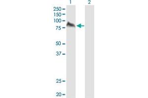 Western Blotting (WB) image for UMOD 293T Cell Transient Overexpression Lysate(Denatured) (ABIN1333855)