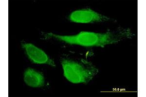 Immunofluorescence (IF) image for anti-Peroxiredoxin 2 (PRDX2) (AA 1-198) antibody (ABIN563132)