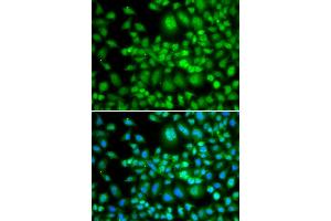 Immunofluorescence analysis of MCF-7 cells using SETD5 antibody (ABIN5974406). (SETD5 抗体)