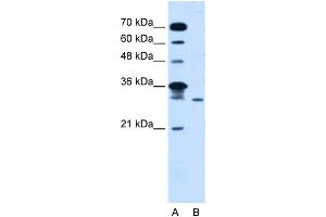 WB Suggested Anti-GLTPD2 Antibody Titration:  5. (GLTPD2 抗体  (Middle Region))