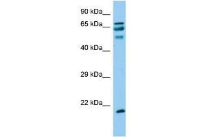 Host: Rabbit Target Name: ANKRD60 Sample Type: Fetal Liver lysates Antibody Dilution: 1. (ANKRD60 抗体  (C-Term))