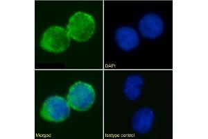 Immunofluorescence staining of Jurkat cells using anti-IL2R antibody AHT107. (Recombinant CD25 抗体)