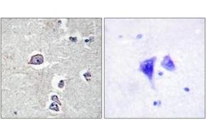 Immunohistochemistry (IHC) image for anti-Platelet Derived Growth Factor Receptor alpha (PDGFRA) (AA 721-770) antibody (ABIN2888854) (PDGFRA 抗体  (AA 721-770))