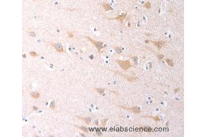 Immunohistochemistry of Human brain using SCGB1A1 Polyclonal Antibody at dilution of 1:60 (SCGB1A1 抗体)