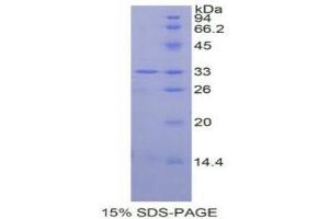 SDS-PAGE analysis of Human MAPK14 Protein. (MAPK14 蛋白)