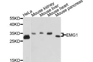 Western blot analysis of extracts of various cell lines, using EMG1 antibody (ABIN5972482) at 1/1000 dilution. (EMG1 抗体)