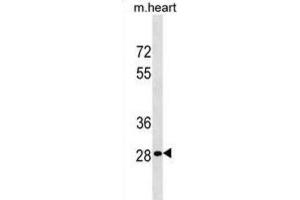 Western Blotting (WB) image for anti-Homeobox B13 (HOXB13) antibody (ABIN3000738) (HOXB13 抗体)