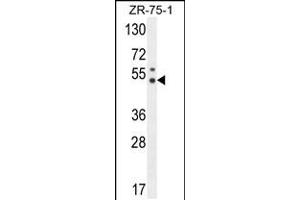 Western blot analysis in ZR-75-1 cell line lysates (35ug/lane). (PUS3 抗体  (N-Term))