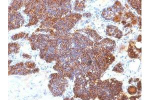 Image no. 1 for anti-Parathyroid Hormone (PTH) (C-Term) antibody (ABIN6166676) (PTH 抗体  (C-Term))