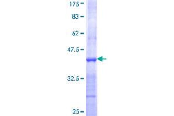 NMNAT2 Protein (AA 208-307) (GST tag)