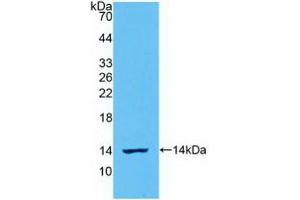 Detection of Recombinant IL8, Ovine using Polyclonal Antibody to Interleukin 8 (IL8) (IL-8 抗体  (AA 23-101))